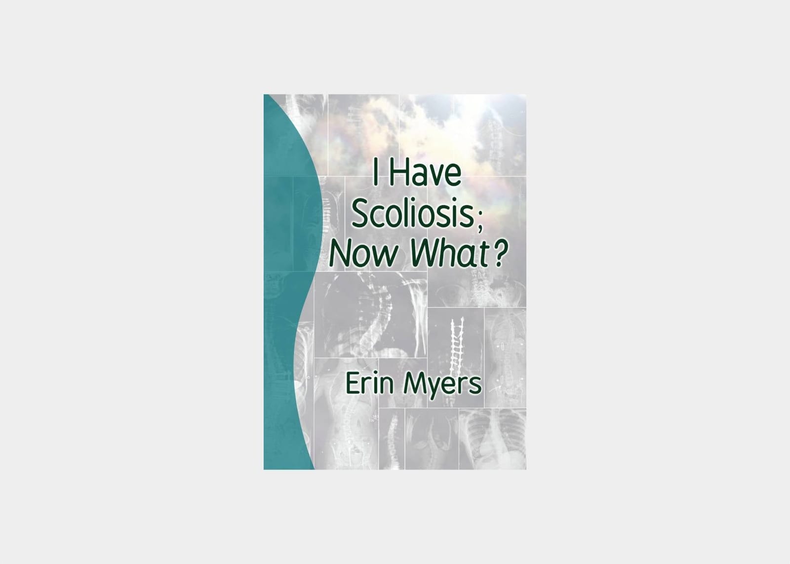 i have scoliosis now what - book - erin myers